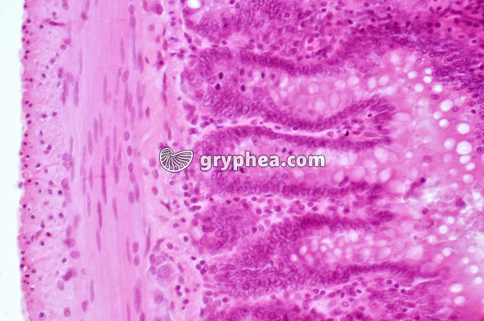 Intestin grêle x100 - gryphea.org